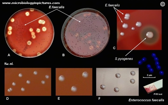 Enterococcus faecalis on blood agar plate